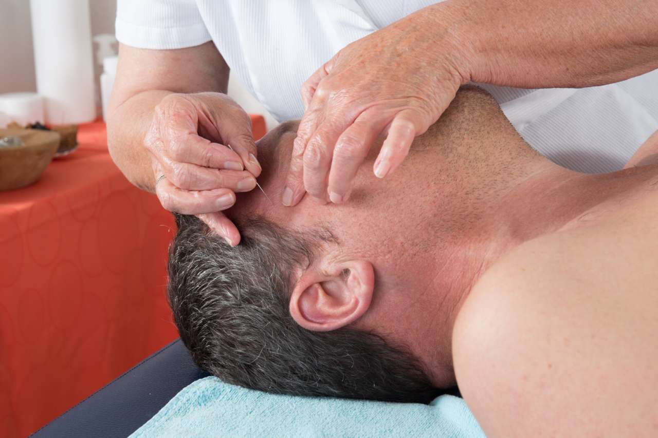 Acupuncture for pituitary tumors